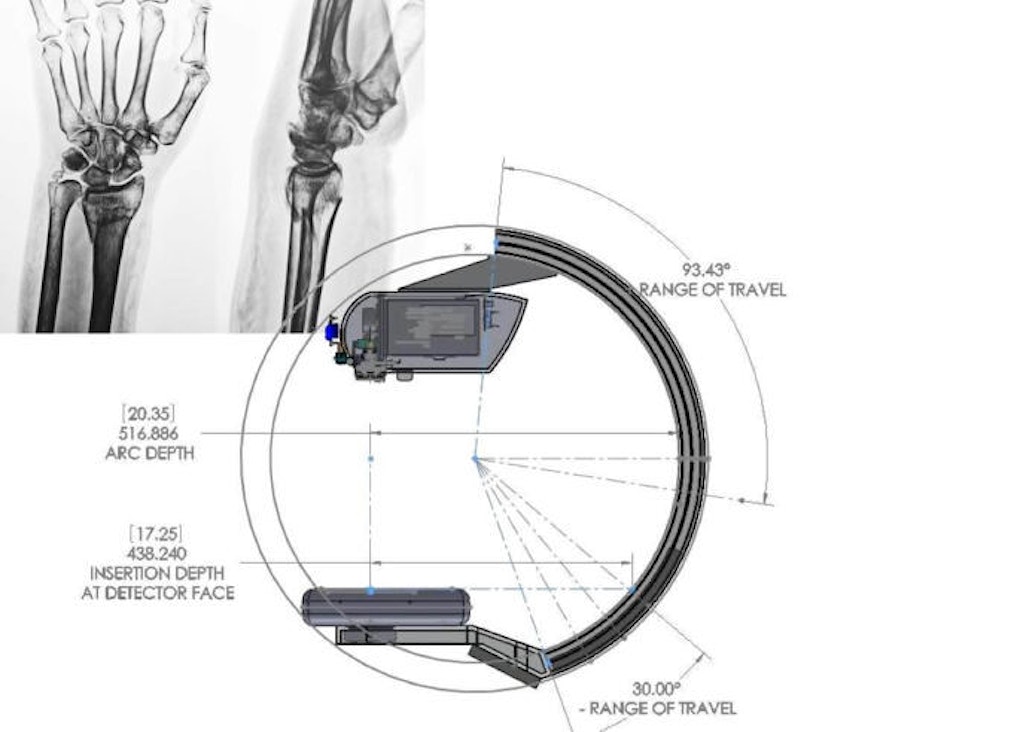 Hologic Fluoroscan